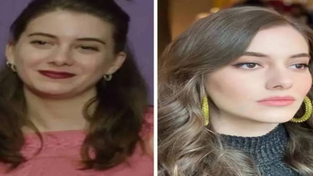 İşte estetikli ünlülerin listesi! Listeyi görünce 'yok artık onda da mı var?' diyeceksiniz 2